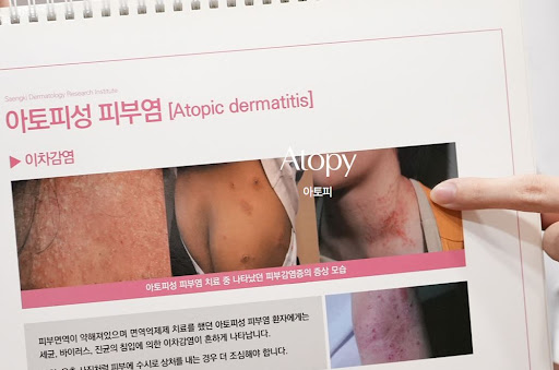 생기한의원으로 확인하는 아토피와 습진의 차이점 정리
